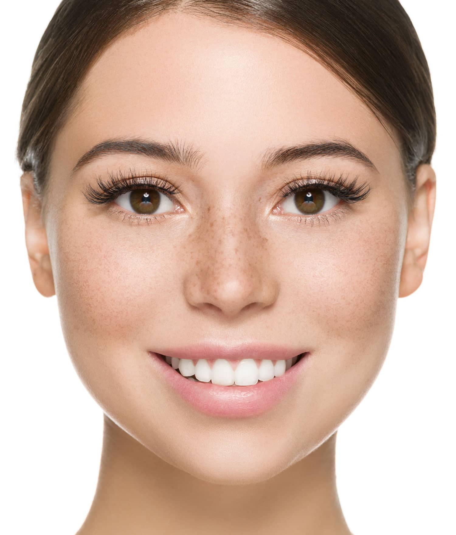 Microneedling Microneedling