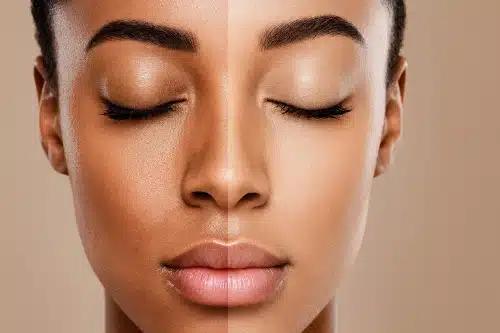 Inside a Brightening Facial: What to Expect