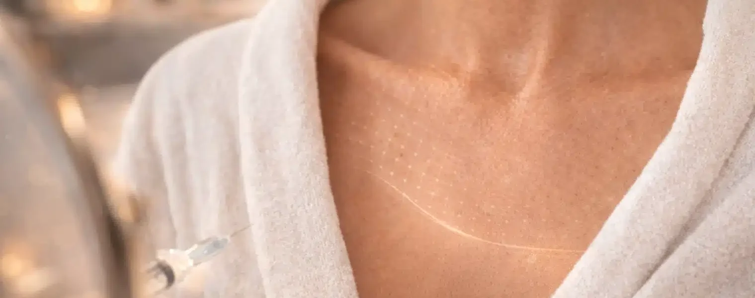 Décolletage wrinkle correction is becoming a real injectable category