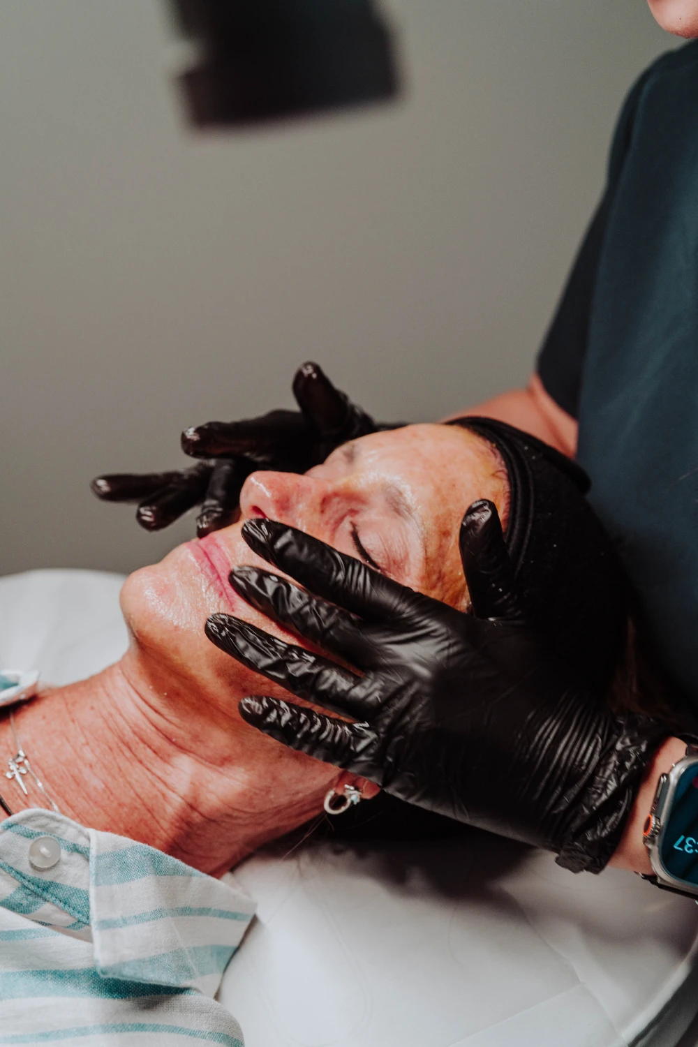 BioRePeel skin revitalization treatment