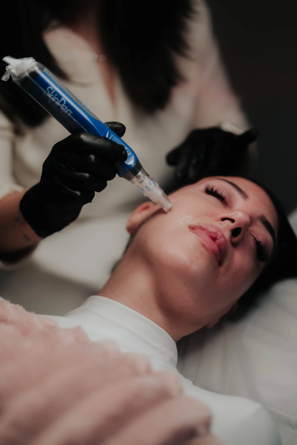 Microneedling treatment experience at Fountain of Youth