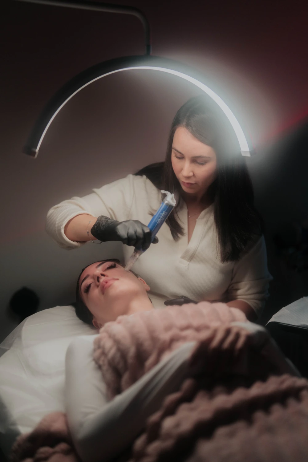 Microneedling procedure