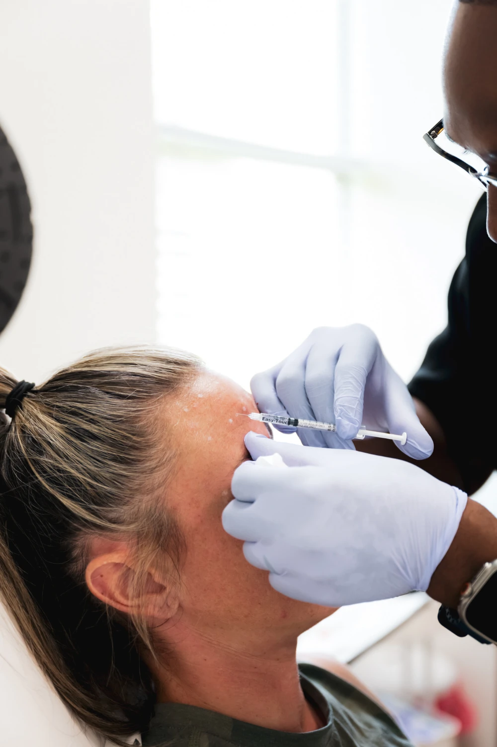 Close view of precise neurotoxin placement in the forehead
