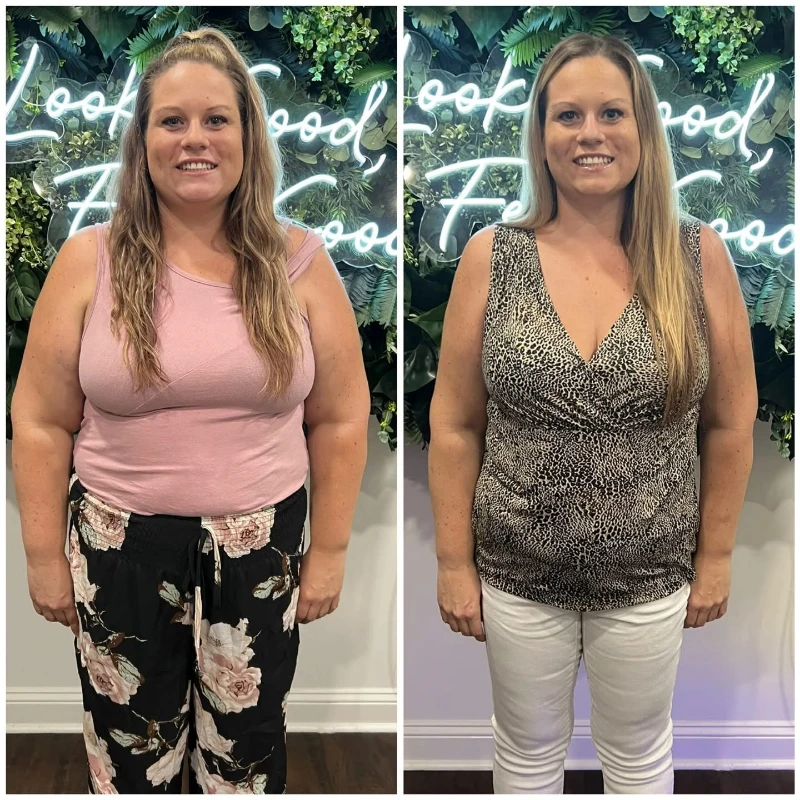 Medical weight management progress comparison 1