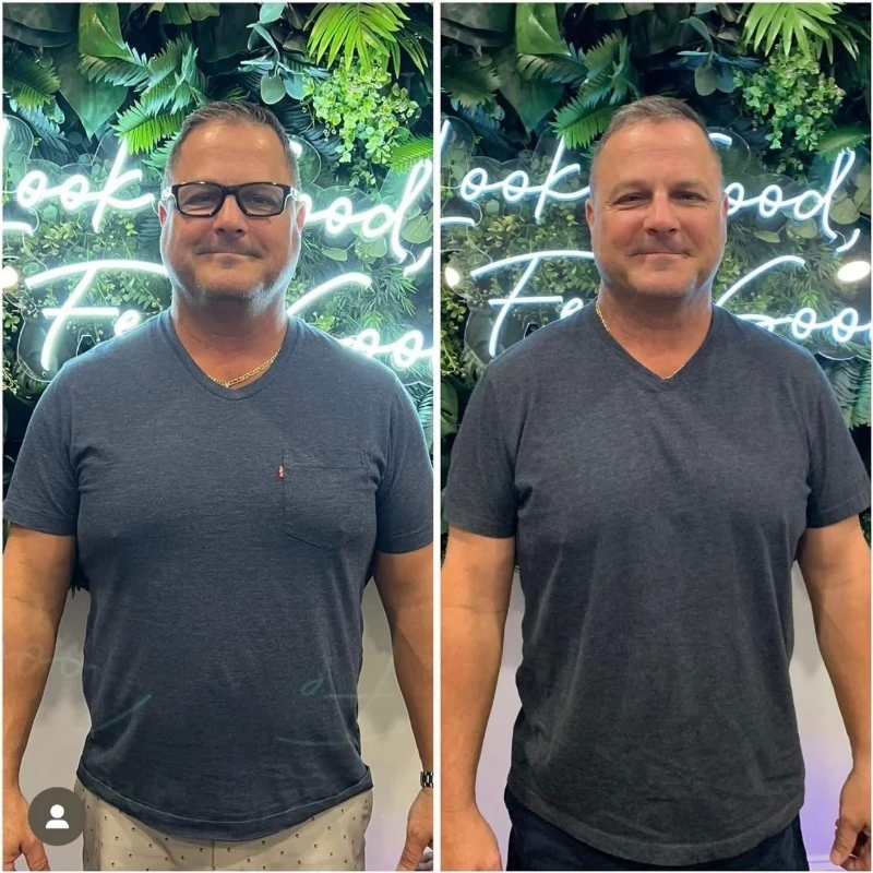 Medical weight management progress comparison 2