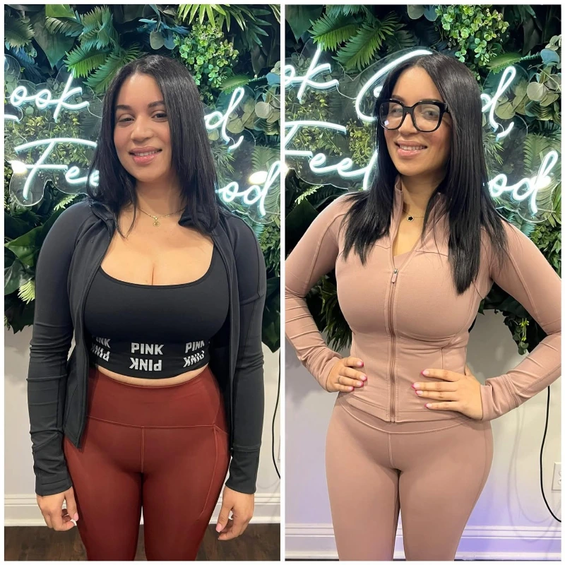 Medical weight management progress comparison 3